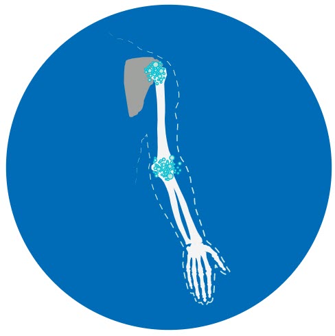 excess nitrogen in your body 